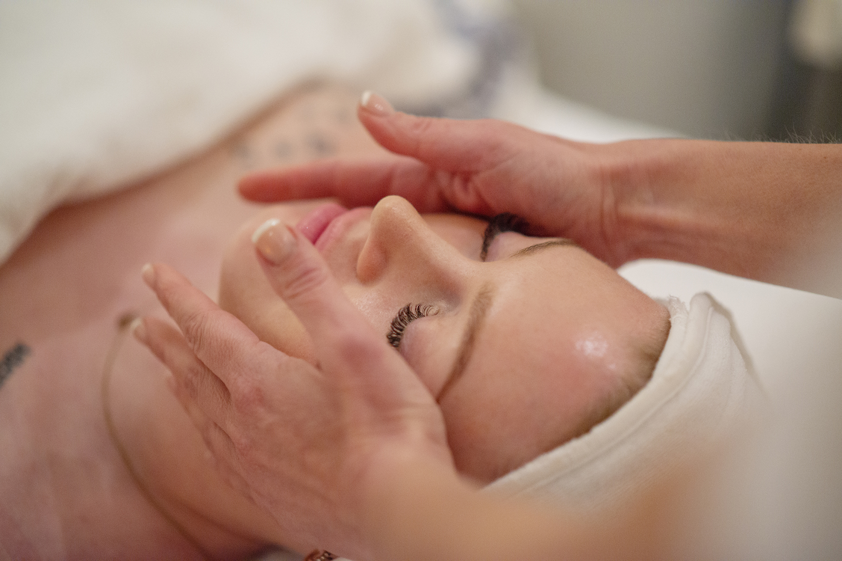 _DSC9114 low Microneedling