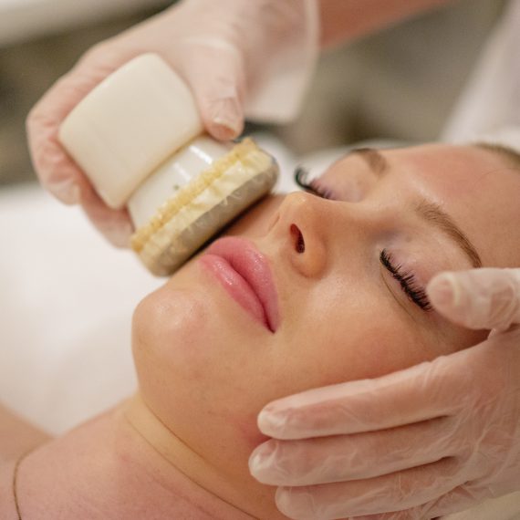 _DSC9238 low Microneedling