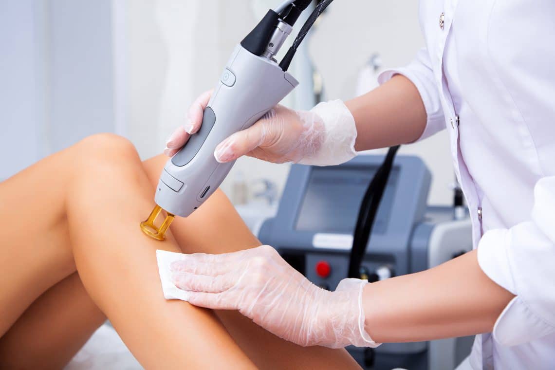 Laser-Hair-Removal-1140x760 Alexandritlaser. Hårborttagning och hårreducering med laser.