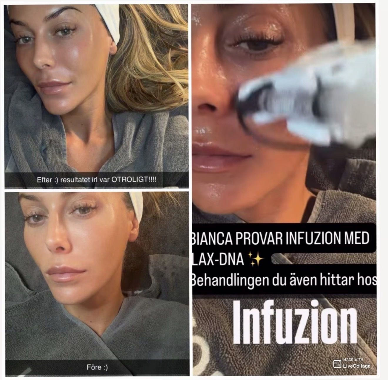 Mesoduo ansiktsbehandling